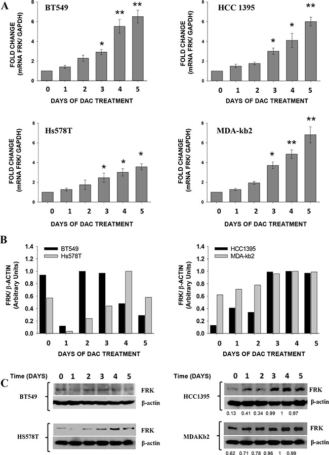 Decitabine (DAC) induces the expression of FRK in breast cancer cells.