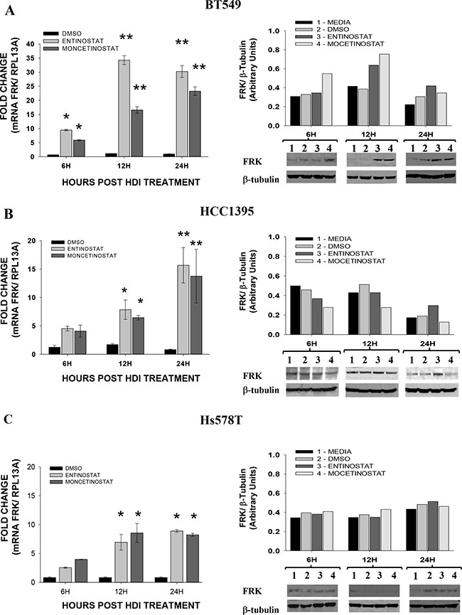 Histone deacetylase Inhibitors induces the expression of FRK in breast cancer cells.