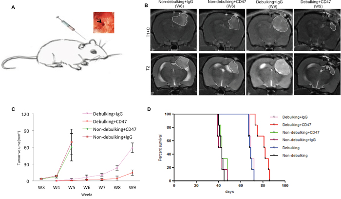 Local injection of anti-CD47 antibody inhibits tumor growth in combination with surgical debulking.