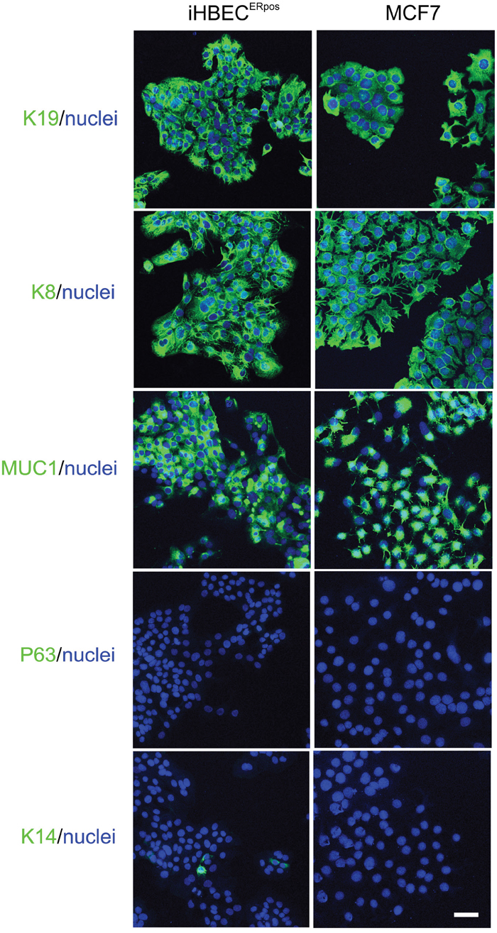 Characterization of hTERT/shp16 transduced iHBECERpos cells.