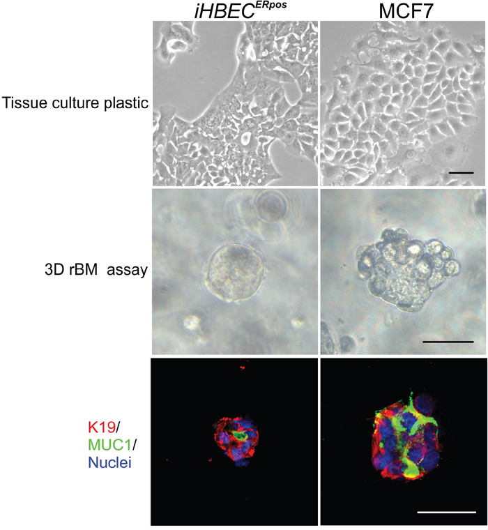 iHBECERpos cells are normal-like by the rBM assay.