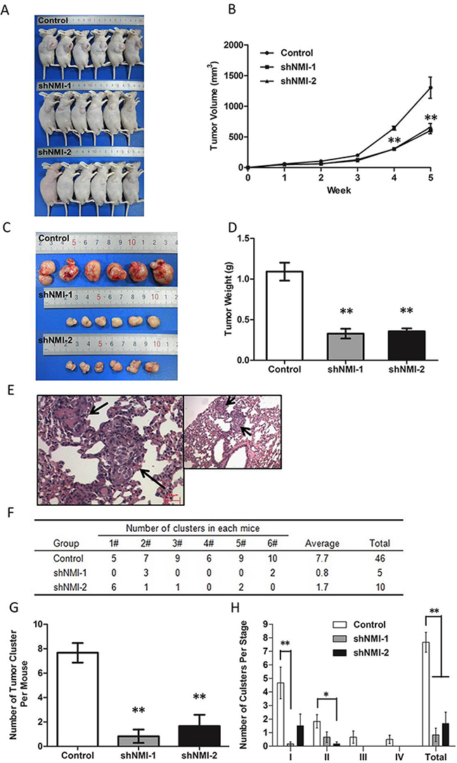 The effects of NMI on in vivo tumor growth and metastasis of HCC in a xenograft nude mice model.