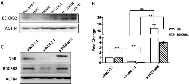 BDKRB2 may be the downstream target of NMI.