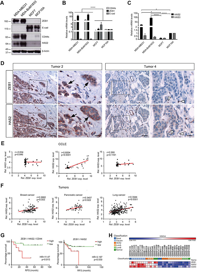 HAS2 correlates with ZEB1 expression and early relapse in breast cancer.