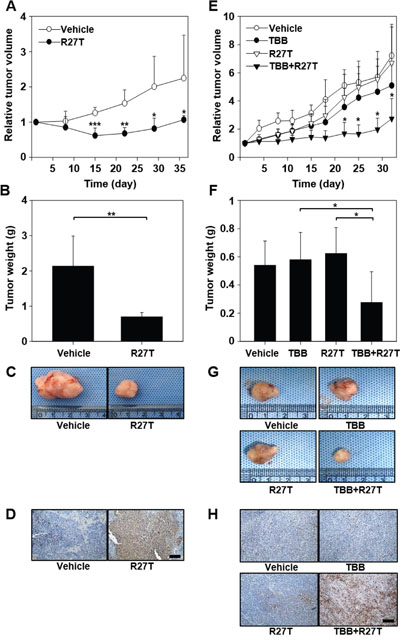 In vivo anti-tumor efficacy of co-treatment with R27T and TBB.