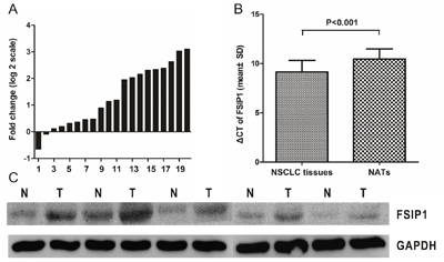 FSIP1 mRNA and protein expression are elevated in NSCLC.