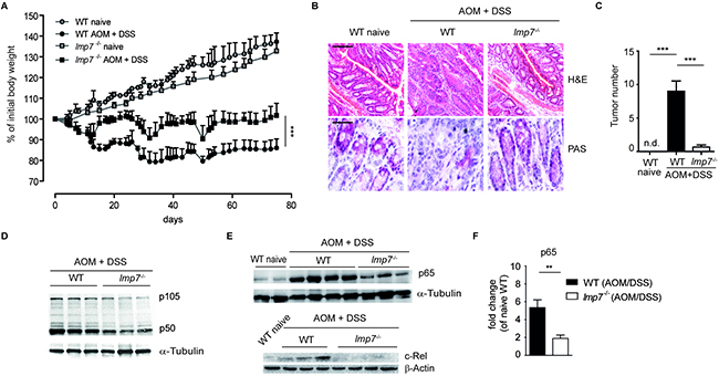 Immunoproteasome subunit LMP7 is essential for development of colitis-associated cancer (CAC).