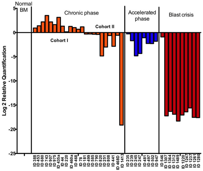 Gadd45a expression is up-regulated in a cohort of chronic phase CML patient samples but down-regulated in accelerated and blast crisis phase samples.