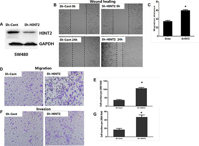 HINT2 downregulation is positively associated with CRC cell metastasis and invasion.