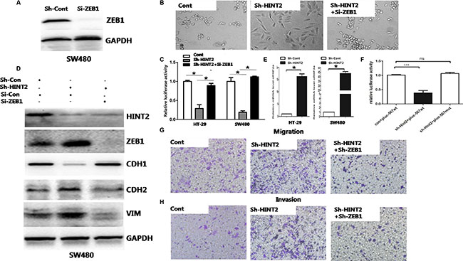 Molecular markers confirm the essential role of ZEB1 in HINT2-induced EMT through HIF-2&#x03B1;.