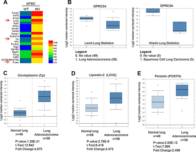 Ceruloplasmin, lipocalin 2 and perioston, among top 20 upregulated genes in Gprc5a knockout vs wild-type mouse tracheal epithelial cells are dysregulated in NSCLC based on data from ONCOMINE.