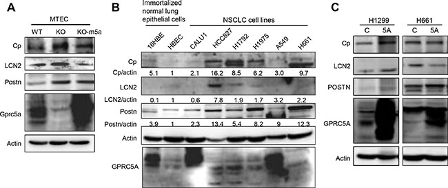 Protein levels of ceruloplasmin, lipocalin 2 and periostin in MTEC and NSCLC cell lines are correlated with repressed GPRC5A.