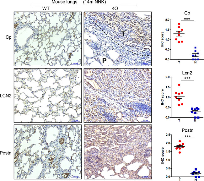 Ceruloplasmin, lipocalin 2 and periostin are upregulated in the lung tumor tissues of Gprc5a-knockout mice compared to wild-type ones.