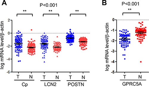 Relative mRNA levels of GPRC5A, ceruloplasmin, lipocalin 2 and periostin in lung tissues of NSCLC.