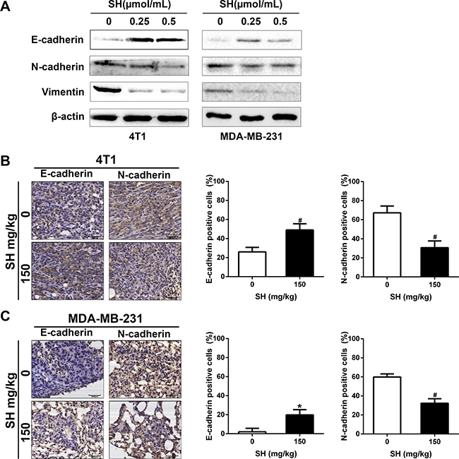 SH reversed EMT process in breast cancer cells.