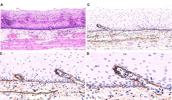 The normal esophageal mucosa.