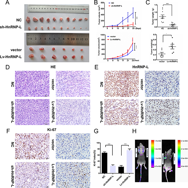HnRNP-L accelerates tumor growth in vivo.