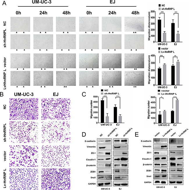 HnRNP-L overexpression enhances migration in UM-UC-3 and EJ cells.