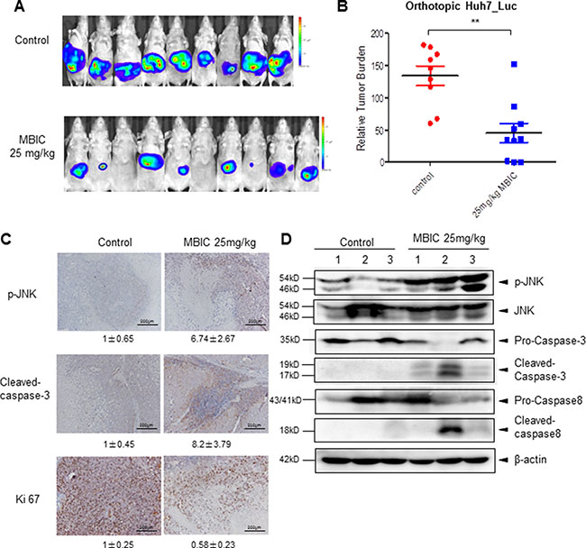 MBIC significantly inhibits tumor growth in an orthotopic mouse model.