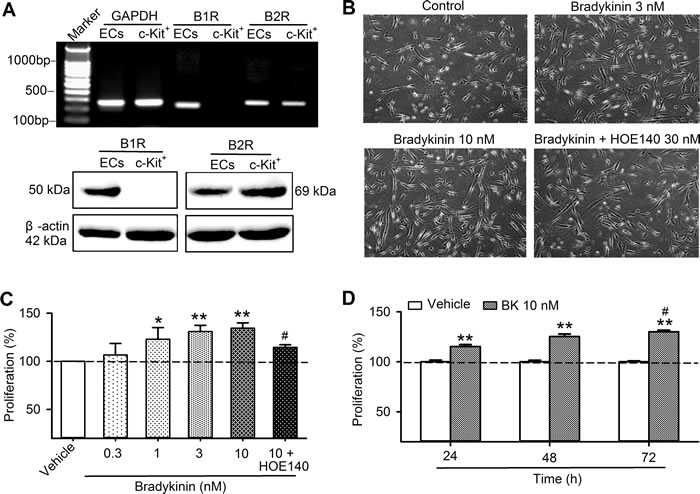 The expression of bradykinin receptors and bradykinin effect on cell proliferation in human cardiac c-Kit