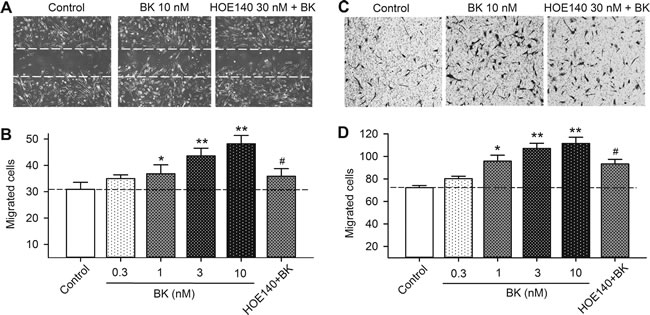 Effect of bradykinin (BK) on cell mobility in human cardiac c-Kit