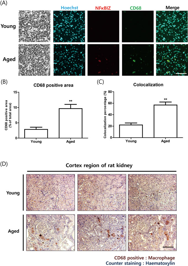 Increased NF-&#x3ba;BIZ protein levels were associated with macrophage infiltration in aged rat kidneys.
