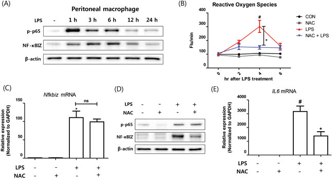 Effect of oxidative stress on NF-&#x3ba;BIZ activation in macrophages.