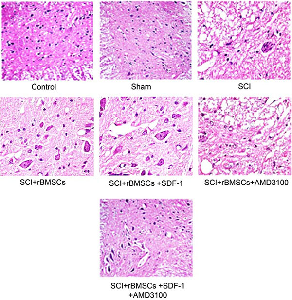 Comparison of the inflammatory reaction 28 days after model establishment detected through HE staining among the blank control, sham, SCI, SCI + BMSCs, SCI + BMSCs + SDF-1, SCI + BMSCs + AMD3100 and SCI + BMSCs + SDF-1 + AMD3100 groups.