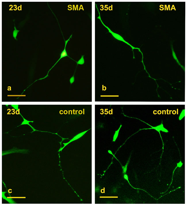 Conversion of SMA and control fibroblasts to motor neurons with 8 transcription factors.