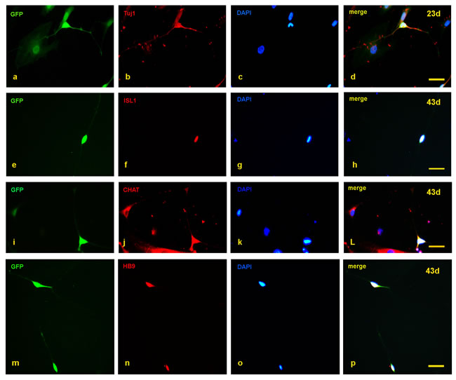 Detection of motor neuron markers with immunofluorescence staining.