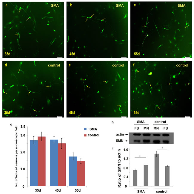 Comparison of the numbers of induced motor neurons in 10&times; microscopic fields between the SMA and control group.