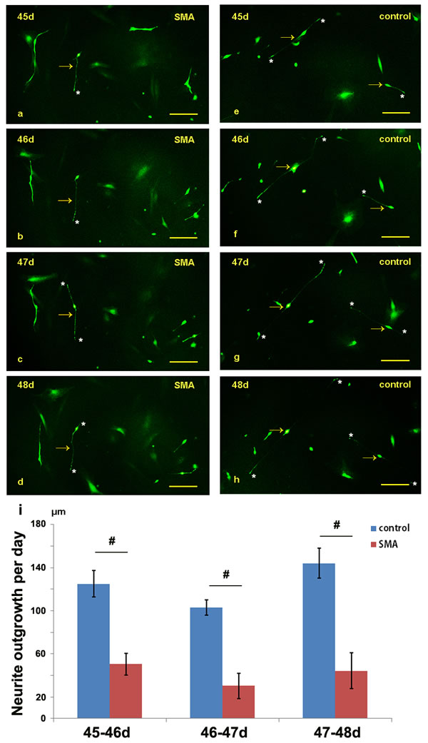 Comparison of the neurite lengths between the SMA and control group from day 45 to 48.