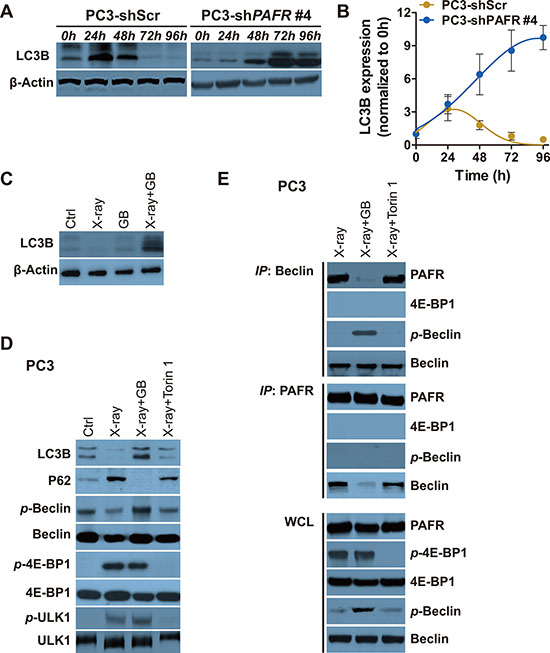 Irradiation-induced increasement of PAFR inhibits Beclin 1 phosphorylation and autophagy.