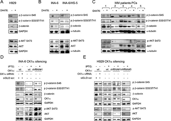 Effects of CK1 inactivation on &#x03B2;-catenin and AKT signalling pathways.