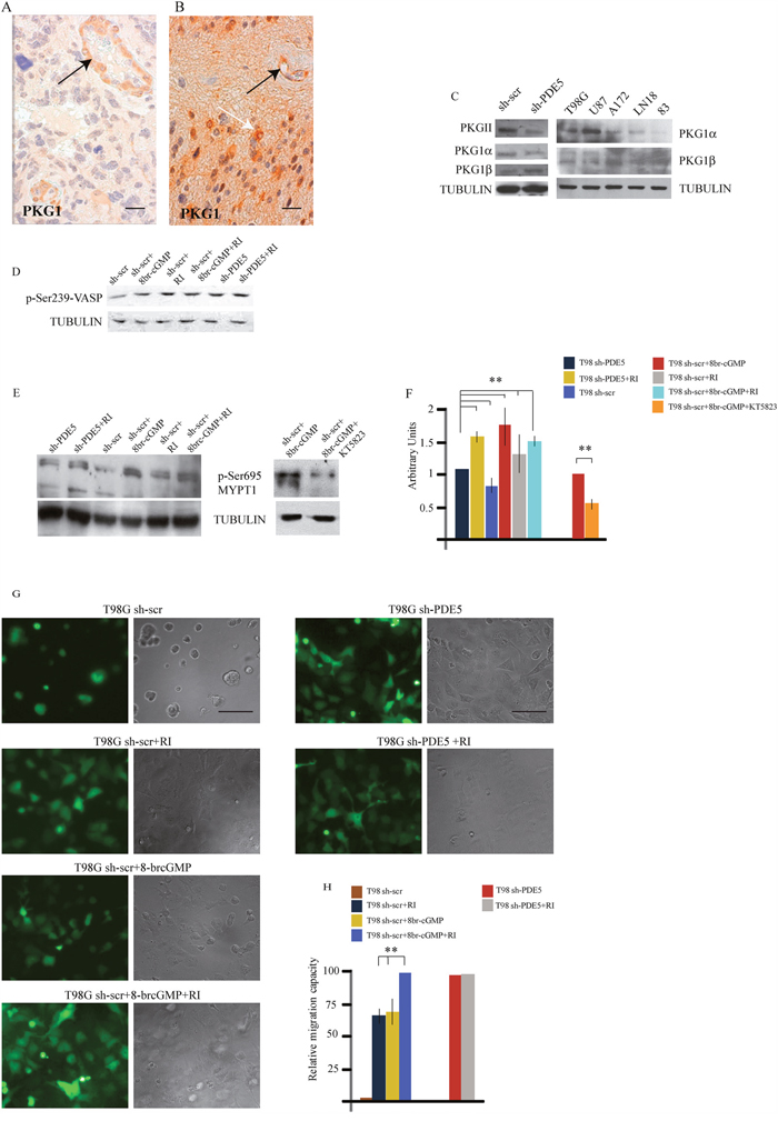 PKG expression and MYPT1 phosphorylation regulates GBM cells migration.