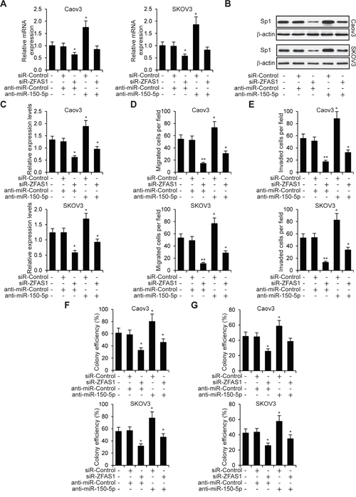 ZFAS1 promotes EOC cells through miR-150-5p mediated Sp1.