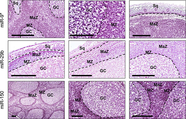 MiR-9*, miR-29b and miR-150 distribution in normal tonsillar tissue.