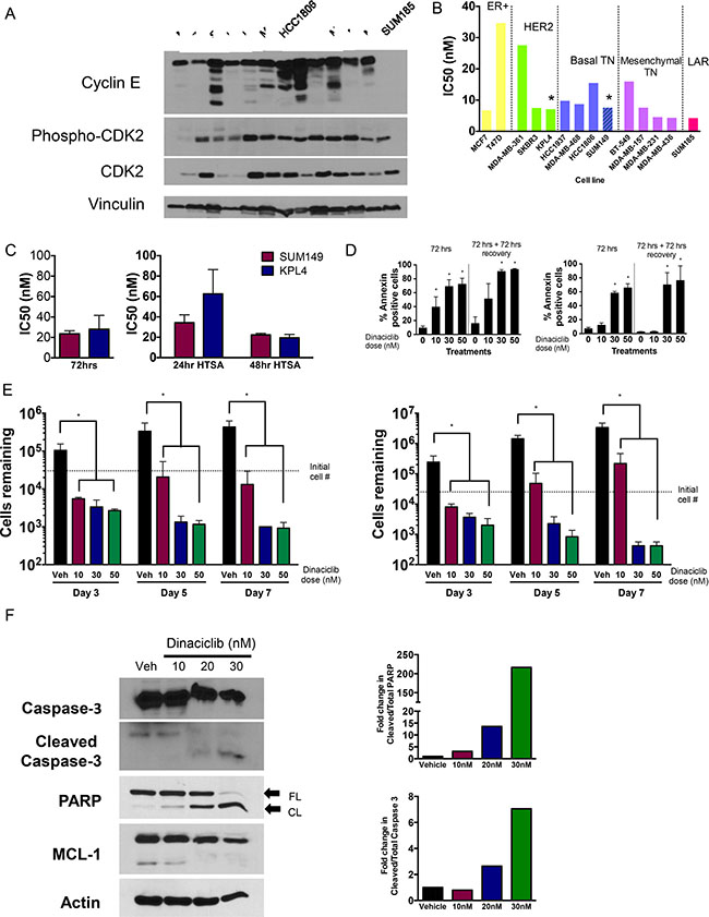 CDK2 is a target in breast cancers including IBC.