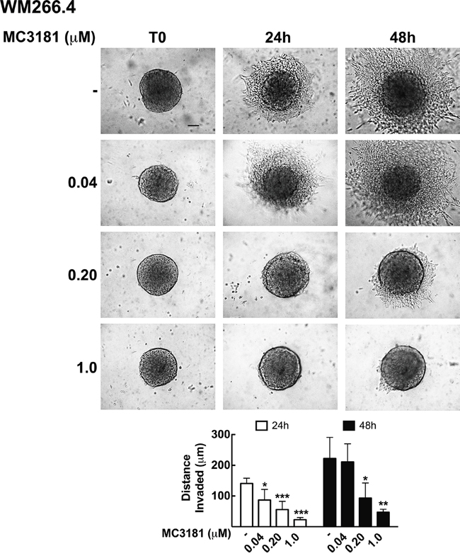 MC3181 inhibits WM266.4 spheroids invasion into type I collagen.