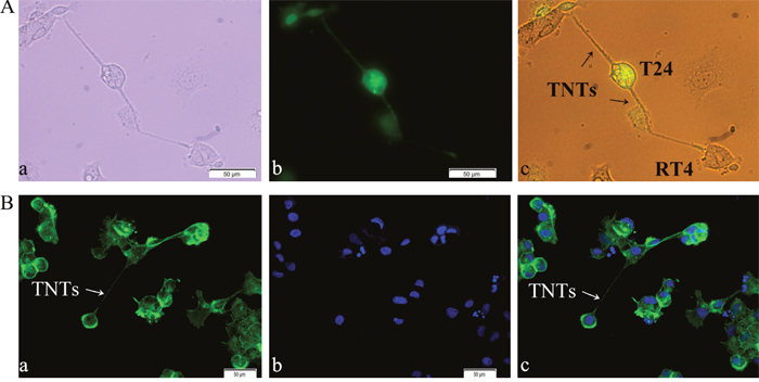 Identification of TNT structure between T24 and RT4 cells by light and fluorescence microscopy.