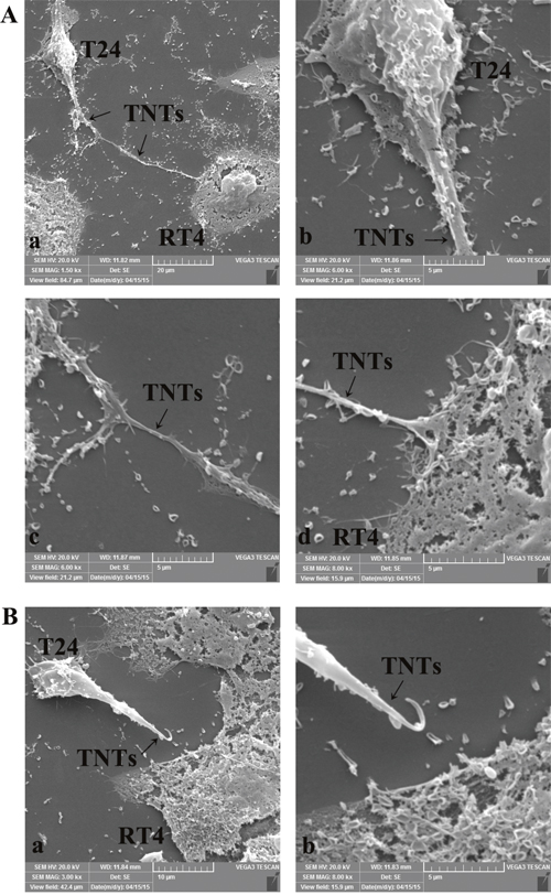 Identification of TNTs micro-structure between T24 and RT4 cells by scanning electron microscopy.