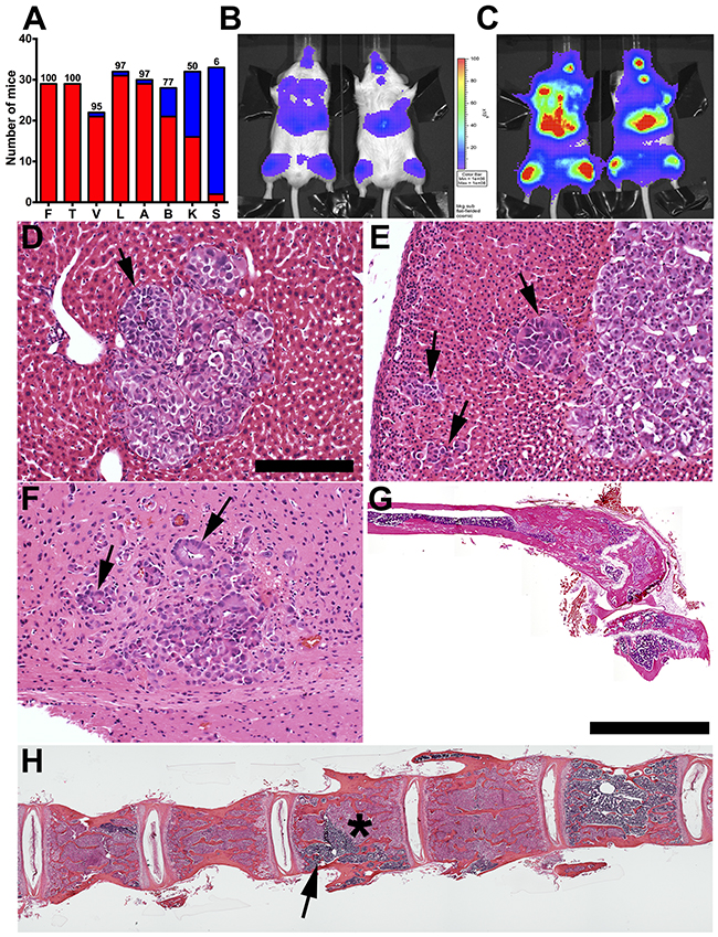 Incidence, kinetics, and histopathology of skeletal and solid organ metastases in NOD/SCID/IL2R&#x03B3; (NSG) immunodeficient mice.