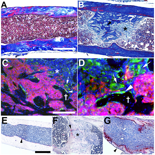 IGR-CaP1 cells create osteoblastic metastases at multiple skeletal sites.