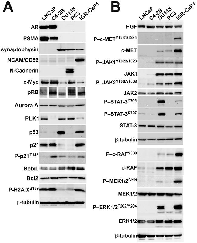 IGR-CaP1 cells express a subset of molecules coordinating the aggressive disease phenotype.