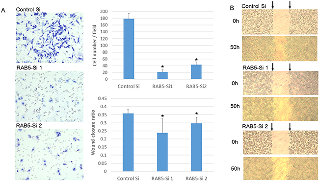 Invasion and migration assays of SUIT-2 cells treated by RAB5 siRNA.