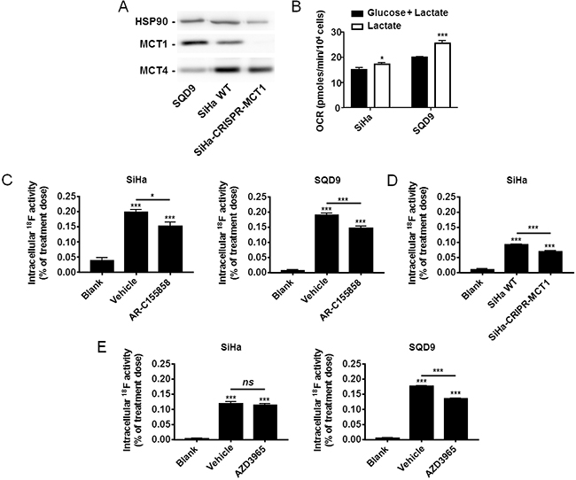 Oxidative human cancer cells trap [18F]-FLac in a MCT1-dependent manner.