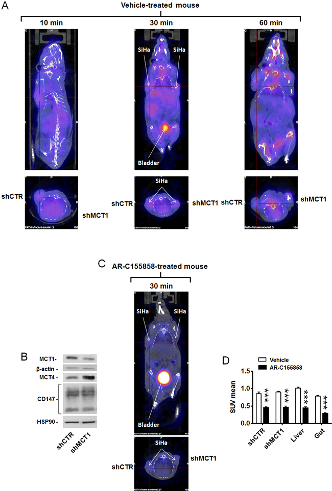 MCT1 inhibitor AR-C155858 blocks the in vivo uptake of [18F]-FLac by human SiHa tumors in mice.