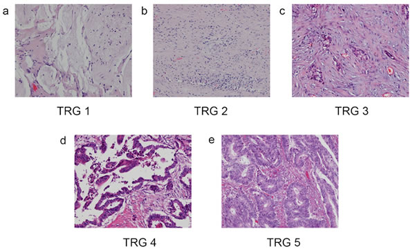 Examples of TRG.