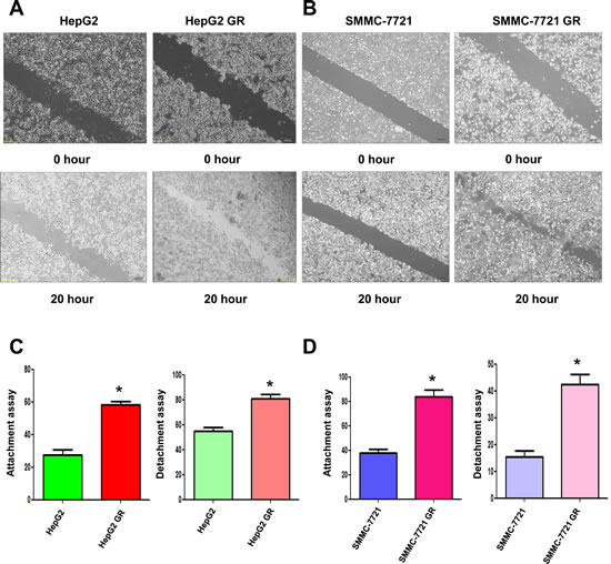 HCC GR cells have increased migratory capacity.