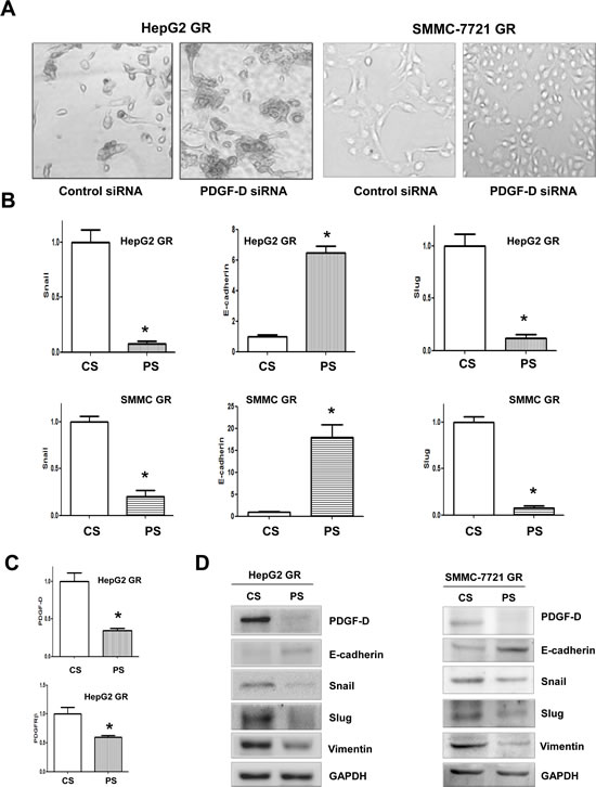 PDGF-D contributes to the regulation of EMT markers in HCC GR cells.